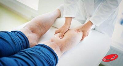  با چند عادت ساده از ابتلا به واریس پیشگیری کنیم + عوامل موثر در بروز واریس - کلبه سرگرمی