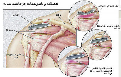  چطور شانه‌ها را در خانه ورزش دهیم؟ - مجله اینترنتی کولاک