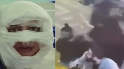  لحظه وحشتناک اسیدپاشی به یک زن