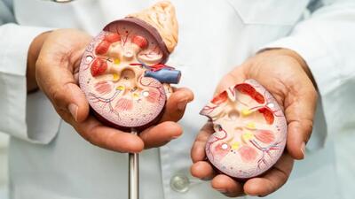  بیماران دیابتی چرا باید از کلیه مراقبت کنند؟ + فیلم
