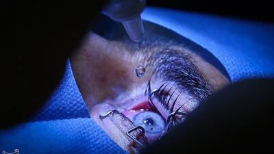 ردپای یک پزشک و مقام سابق مشهور در انجام جراحی ممنوعه/ اعزام بیماران از ایران به عمان برای تغییر رنگ چشم