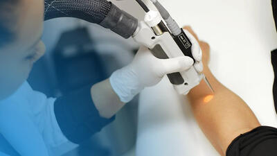  لیزر شاتی سایناشور الیت 2025 در تهران – کلینیک تخصصی پوست و لیزر دکتر پونه یزدانی