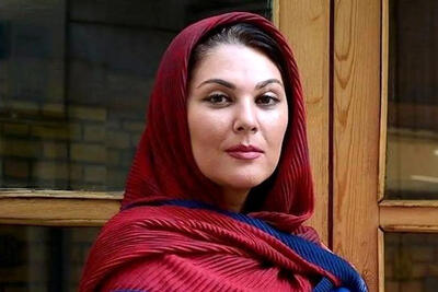  تغییر چهره لاله اسکندری بعد از عمل زیبایی