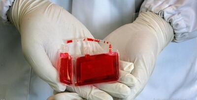  با ذخیره سازی 250 هزار نمونه سلول بنیادی خون بند ناف در رتبه دوم جهان هستیم