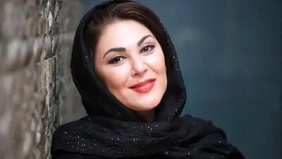  لاله اسکندری با تغییر چهره همه را شگفت زده کرد؛ از بازیگری تا زندگی روستایی!