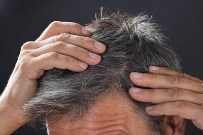  علت سفید شدن مو از نظر طب سنتی