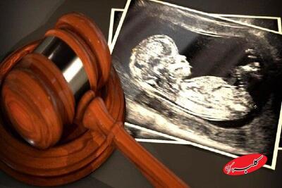  ۸۰ درصد شکایات سقط جنین خانوادگی است؛ دشواری اثبات سقط عمدی - کلبه سرگرمی