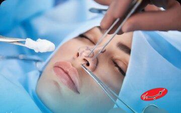  جراحی بینی بدون بیهوشی توسط دستیار دیپلمه پزشک - کلبه سرگرمی
