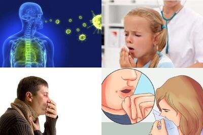  موارد ابتلا به سل در جهان به بالاترین حد خود رسیده است