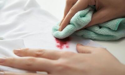  روش از بین بردن لکه‌های سمج لبو از لباس