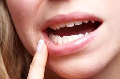  دلیل درد لثه و فک پایین چیست؟