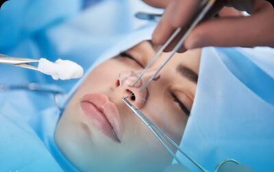  جراحی بینی توسط فرد دیپلمه با بی‌حسی موضعی