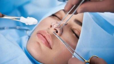  افزایش شکایات از جراحی‌های زیبایی