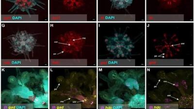  میگنا - تمام بدن این جانور دریایی «مغز» است