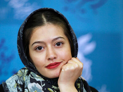  تاریخ امروز چهره‌ها |چهره شوکه کننده از چهره تغییر یافته «پردیس احمدیه»»