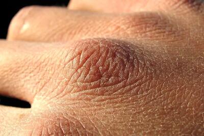  چرا بدن در پاییز تشنه‌تر است؟ | بهترین راهکار برای درمان کم آبی بدن چیست؟