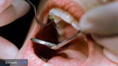  راهی جدید برای کنترل قند خون کشف شد