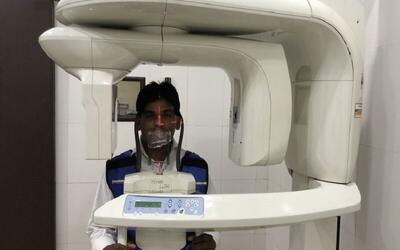  بهره‌برداری از نخستین دستگاه رادیوگرافی فک و صورت در خاش؛ پایان ارجاع بیماران به زاهدان