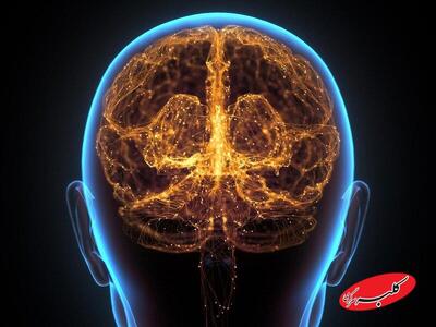  مراقب این علائم هشدار دهنده اولیه فراموشی باشید - کلبه سرگرمی