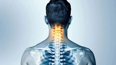  پایین نگه داشتن گردن عامل اصلی ابتلا به دیسک گردن (فیلم)