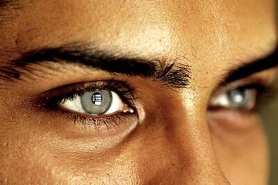  این عمل زیبایی می‌تواند بینایی شما را از بین ببرد!