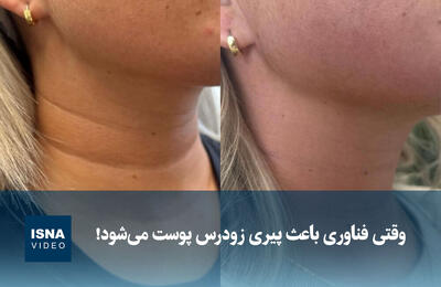  ویدیو/ وقتی فناوری باعث پیری زودرس پوست می‌شود!