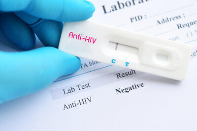  «انگ اجتماعی» چگونه مانع تست HIV می‌شود؟