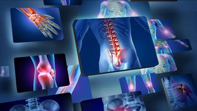  پزشکان بریتانیایی از هوش مصنوعی برای تشخیص و درمان شکستگی‌ها استفاده می‌کنند