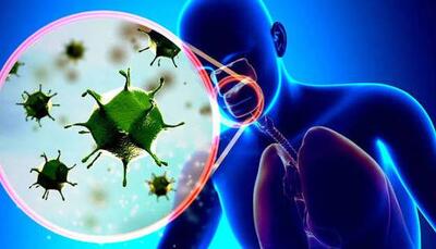  نکته‌های پیشگیری از ابتلا به آنفلوآنزا