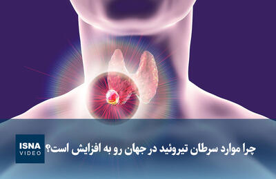  ویدیو/ چرا موارد سرطان تیروئید در جهان رو به افزایش است؟
