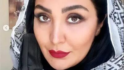  تغییر باورنکردنی در چهره مریم معصومی؛ باور می‌کنید این بازیگر کیست؟