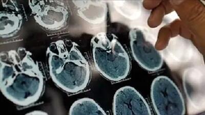  به این دلیل، پنیر بخورید