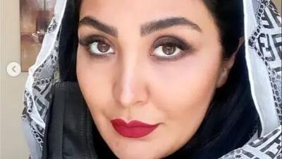  مریم معصومی تغییر چهره داد ؛ خانم بازیگر قابل شناسایی نیست