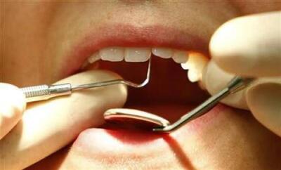  استفاده از کراتین مو برای ترمیم مینای دندان؛ نوآوری تازه در مقابله با پوسیدگی