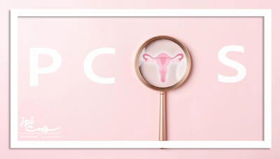  ۶ راهکار ساده و مؤثر برای مدیریت علائم PCOS