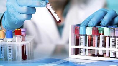  برخی کیت‌های آزمایشگاهی کیفیت لازم را ندارند/ خدمات آزمایشگاهی به کالایی لوکس تبدیل شده است