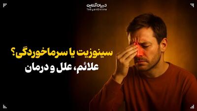  سینوزیت یا سرماخوردگی؟ علائم، علل و درمان