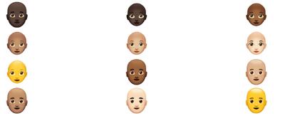  این هوش ‌مصنوعی مشکل ریزش موی شما را حل می‌کند