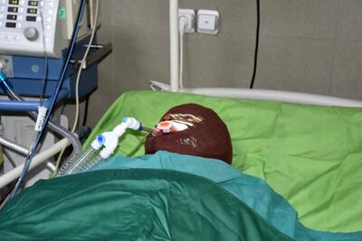  ماجرای اسیدپاشی هولناک روی پدر و دختر در تهران