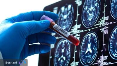  کشف فوق‌نادرترین نوع خون جهان در سه نفر