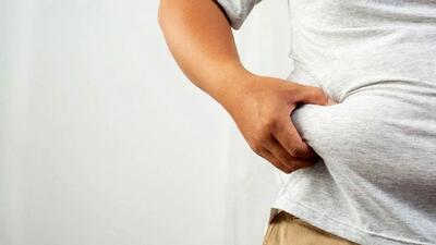  نیمی از افراد جامعه مشکل اضافه وزن دارند