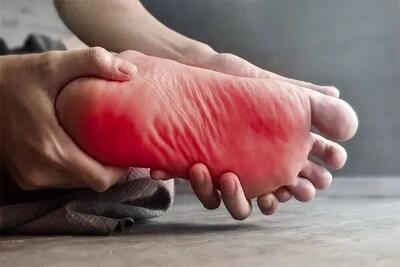  داغی کف پا در شب نشانه ابتلا به این بیماری است
