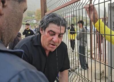  سراج: مرگ را مقابل چشمانمان دیدیم!