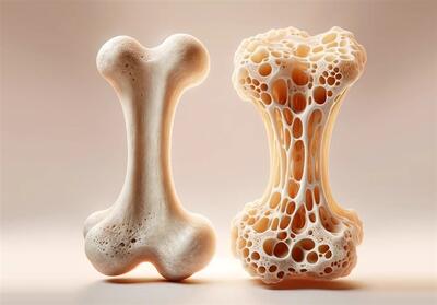  راهی جدید برای ترمیم پوکی استخوان - پاسخ دانشمندان