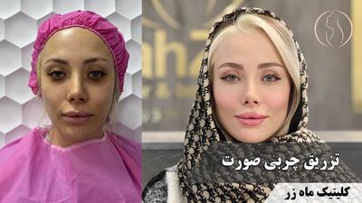  همیشه لازم نیست دنبال انگیزه بگردی ( کلینیک زیبایی ماه زر )
