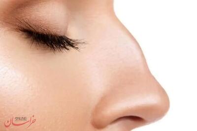  قوز بینی، ترند زیبایی سال ۲۰۲۶