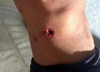  اعتراض آلومینیوم اراک به نحوه قضاوت دیدار با فجرسپاسی با انتشار تصویر مصدومیت جرجانی - پارس فوتبال