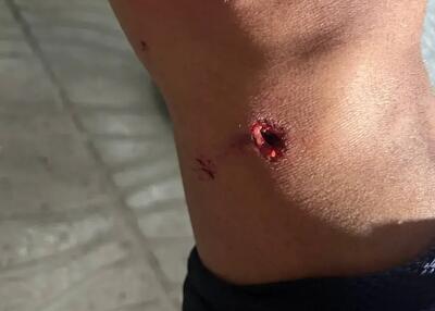  مصدوم آلومینیوم را با آمبولانس بردند(عکس)