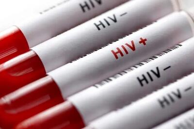  آزمایش ایدز رایگان و محرمانه انجام می‌شود/ازدواج و اشتغال 2 چالش اجتماعی مبتلایان HIV