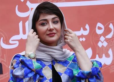  قیافه ویدا جوان بعد عمل زیبایی؟! عکس قدیمی و جدیدش که پربازدید شد